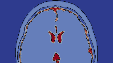 Séminaire de Stéphanie Lohrengel